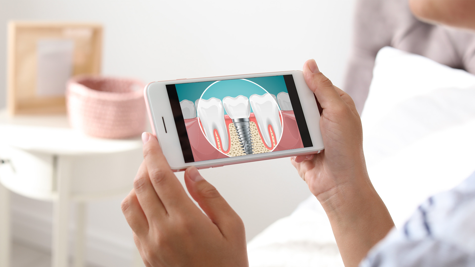 Image  A person holding a smartphone displaying an image of a tooth with a magnified view, showing the internal structure and dental implant.