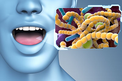 The image features a man with an open mouth, showing teeth, in front of a graphic representation of bacteria and viruses.