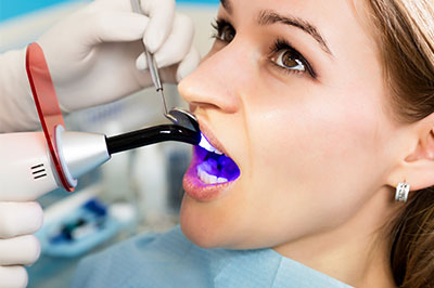 A woman in a dental chair receiving a teeth cleaning, with a dentist using an electric toothbrush and purple dye to stain the plaque.