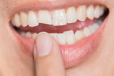 An individual s hand holding a toothbrush up to their teeth, with the focus on a close-up of the brushing action.