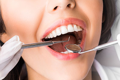 A woman with a wide smile is seated in a dental chair, receiving dental care as evidenced by the dental tools visible in her mouth.