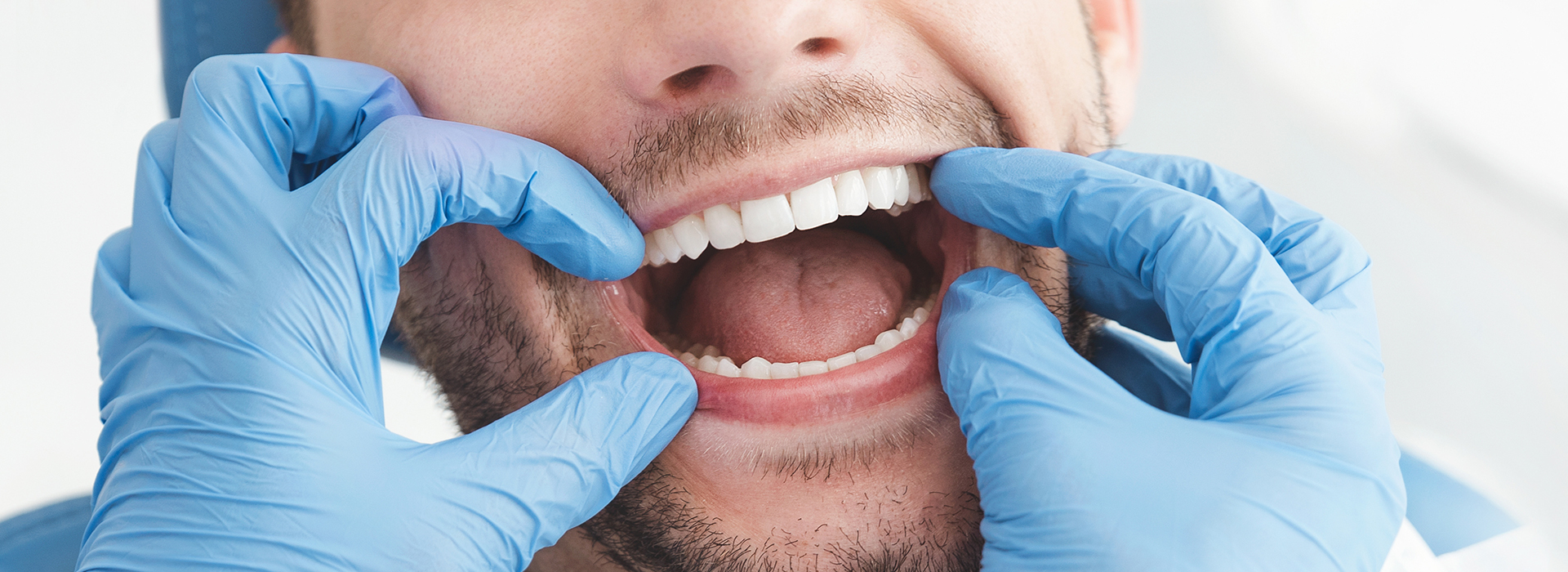 The image shows a man with his mouth open, wearing blue gloves and a face mask, which suggests he may be a dental professional or healthcare worker.