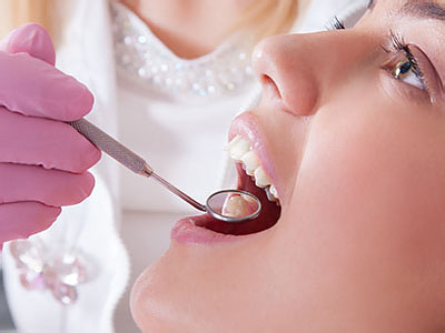 The image shows a dental professional using a dental tool to perform an oral procedure on a patient, with the patient s mouth open and in focus.